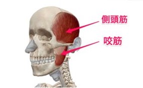 顎関節症１型